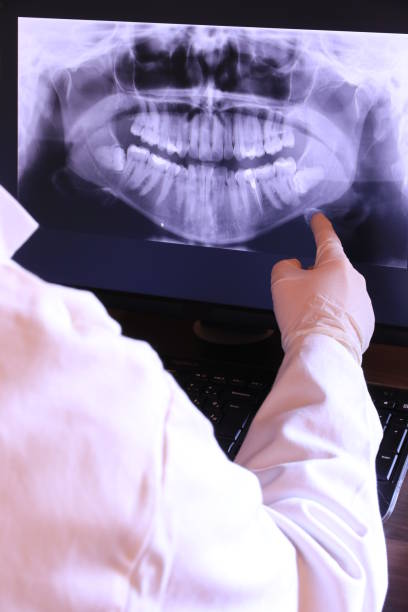 Best Emergency Tooth Extraction in Oxford, KS